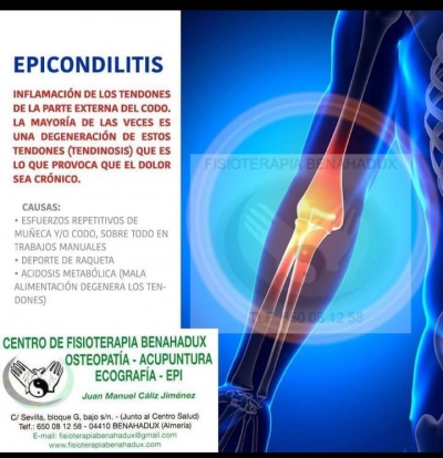 EPICONDILITIS