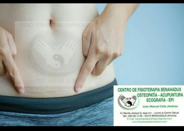 CICATRIZ Y RADIOFRECUENCIA