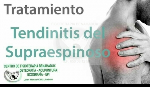TENDINITIS SUPRAESPINOSO