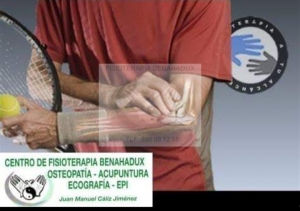 epicondilitis